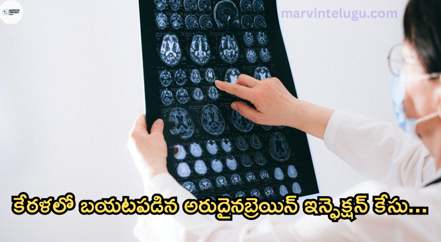 బ్రెయిన్ ఇన్ఫెక్షన్ కేసు rare-case-of-brain-infection-found-in-kerala